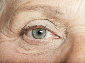 Blepharitis at eye and lasik in athol massachusetts
